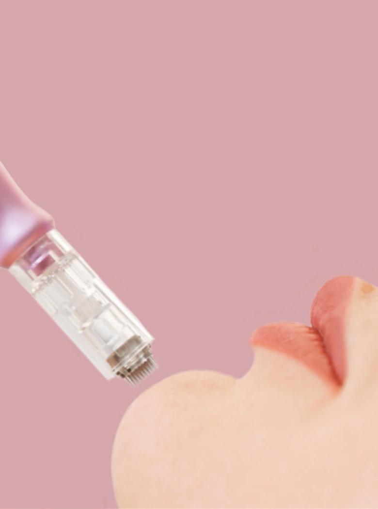 Kalman Aesthetiks Microneedeling